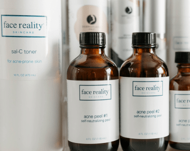 acne chem