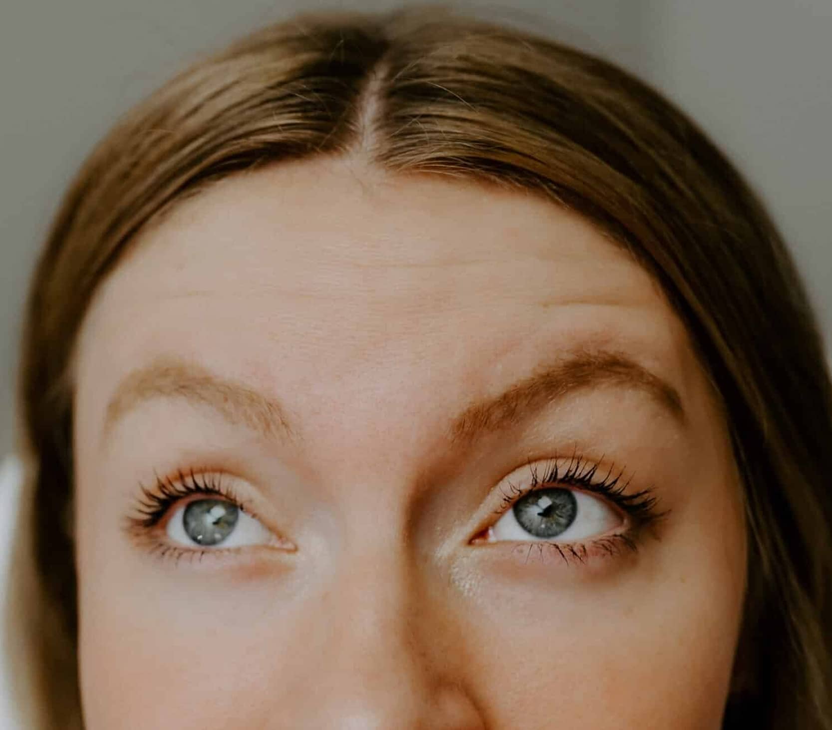 Forehead Lines